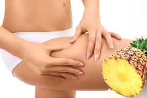 Imagen ilustrativa del artículo La Piña ayuda a Eliminar la Celulitis