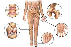 Imagen ilustrativa del artículo Alimentos para combatir la Osteoartritis