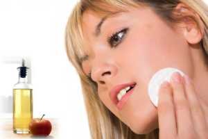 Imagen ilustrativa del artículo Tratamiento natural para el Acné con Vinagre de Manzana
