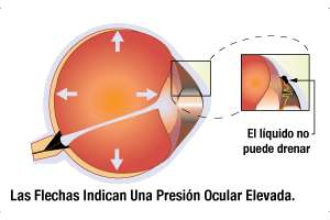 Imagen ilustrativa del artículo Alimentos para Prevenir el Glaucoma de manera natural