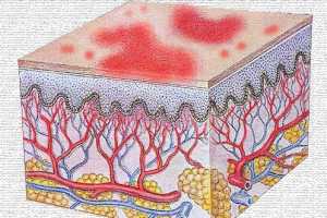 Biotina para aliviar los síntomas de la Dermatitis