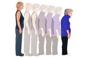 Imagen ilustrativa del artículo Tratamientos naturales para la Osteoporosis