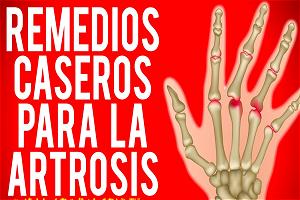 Imagen ilustrativa del artículo Remedios naturales para la Artrosis